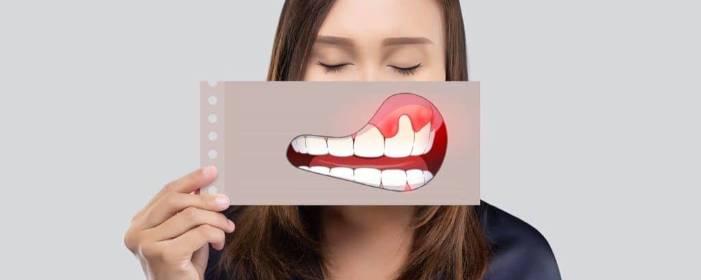 Asian woman in the dark blue shirt holding a paper with the broken tooth cartoon picture of his mouth against the gray background, Decayed tooth, The concept with healthcare gums and teeth